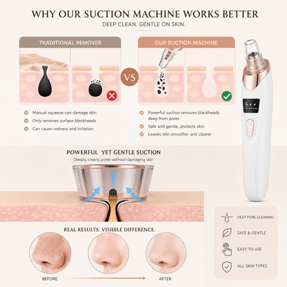 Professional Blackhead and Pore Vacuum