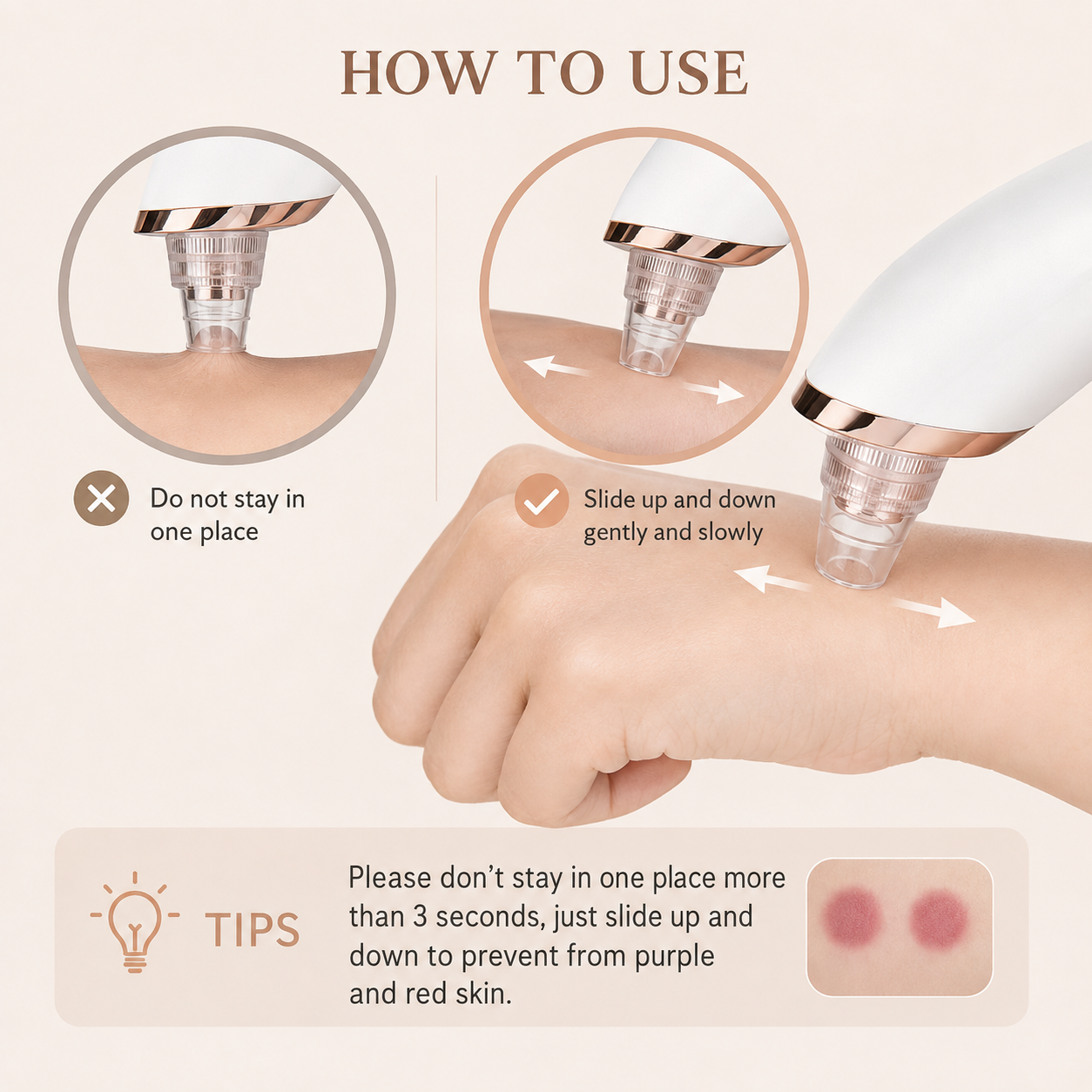 Professional Blackhead and Pore Vacuum